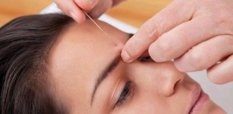 Bei Mundtrockenheit hilft Akupunktur