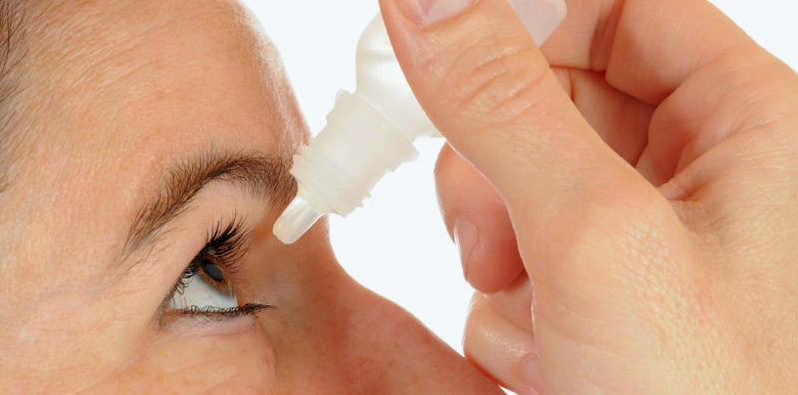Augentropfen mit Hyaluronsäure können mehrmals täglich verwendet werden