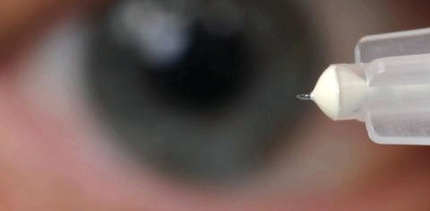 Mikrospritzen gegen Augenkrankheiten