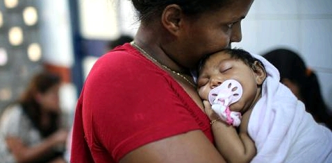 Eine Frau hält ein Baby mit Mikroenzephalie auf dem Arm