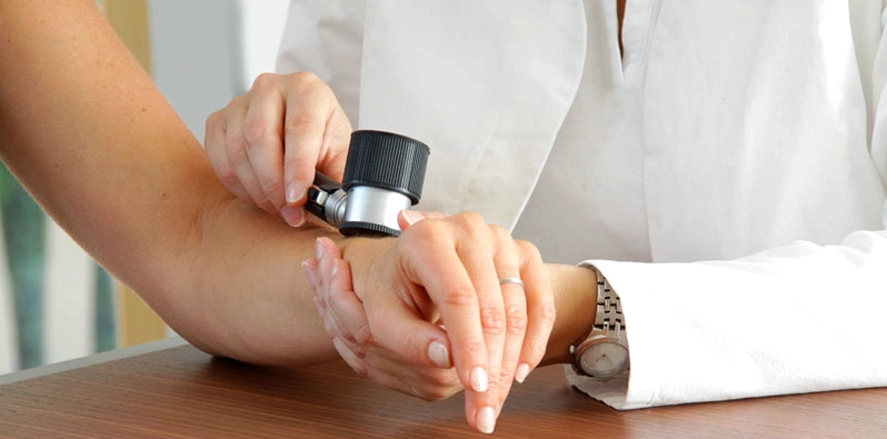 Hautarzt untersucht betroffene Hautstellen