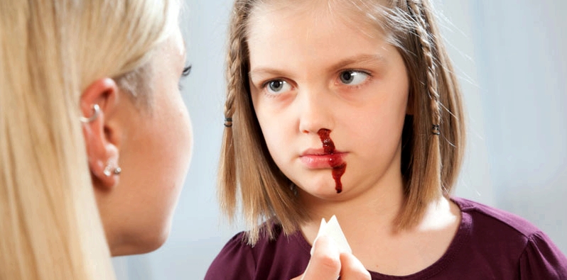 Eine blutende Nase beim Kind wird versorgt