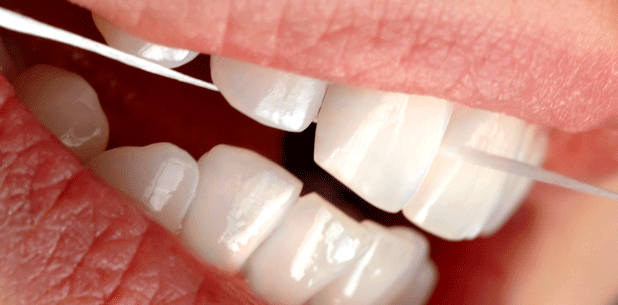 Gegen Bakterien die Karies verursachen hilft Zahnseide