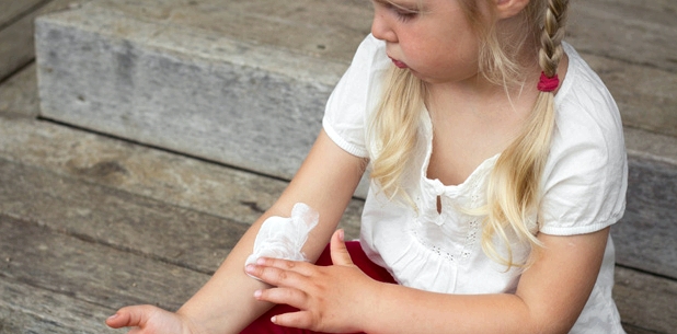 Kind mit Röschenflechte trägt Salbe zur Juckreiz Behandlung auf