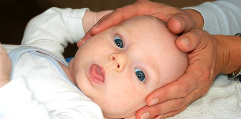 Mit Physiotherapie schiefe Kopfform beim Baby behandeln